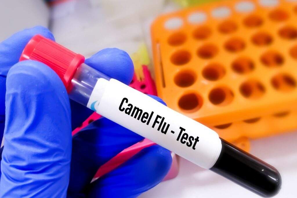 Dopo il Covid arriva un coronavirus più letale: ecco “l’influenza del cammello”