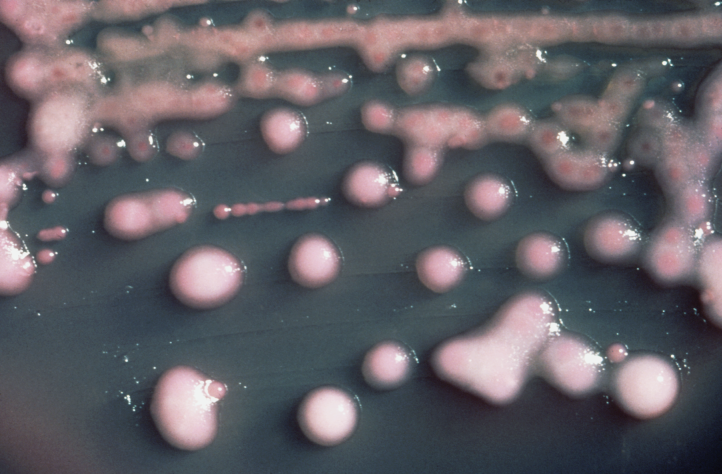 Malasanità: “Klebsiella al Maggiore? Anche al Don Gnocchi”