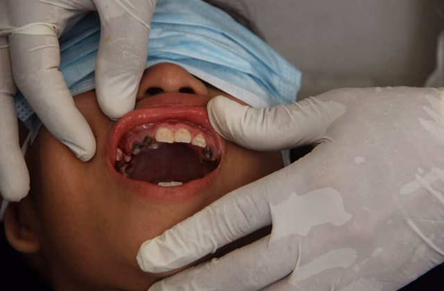 Bambini dal dentista senza paura, come trasformare la visita in un’esperienza serena
